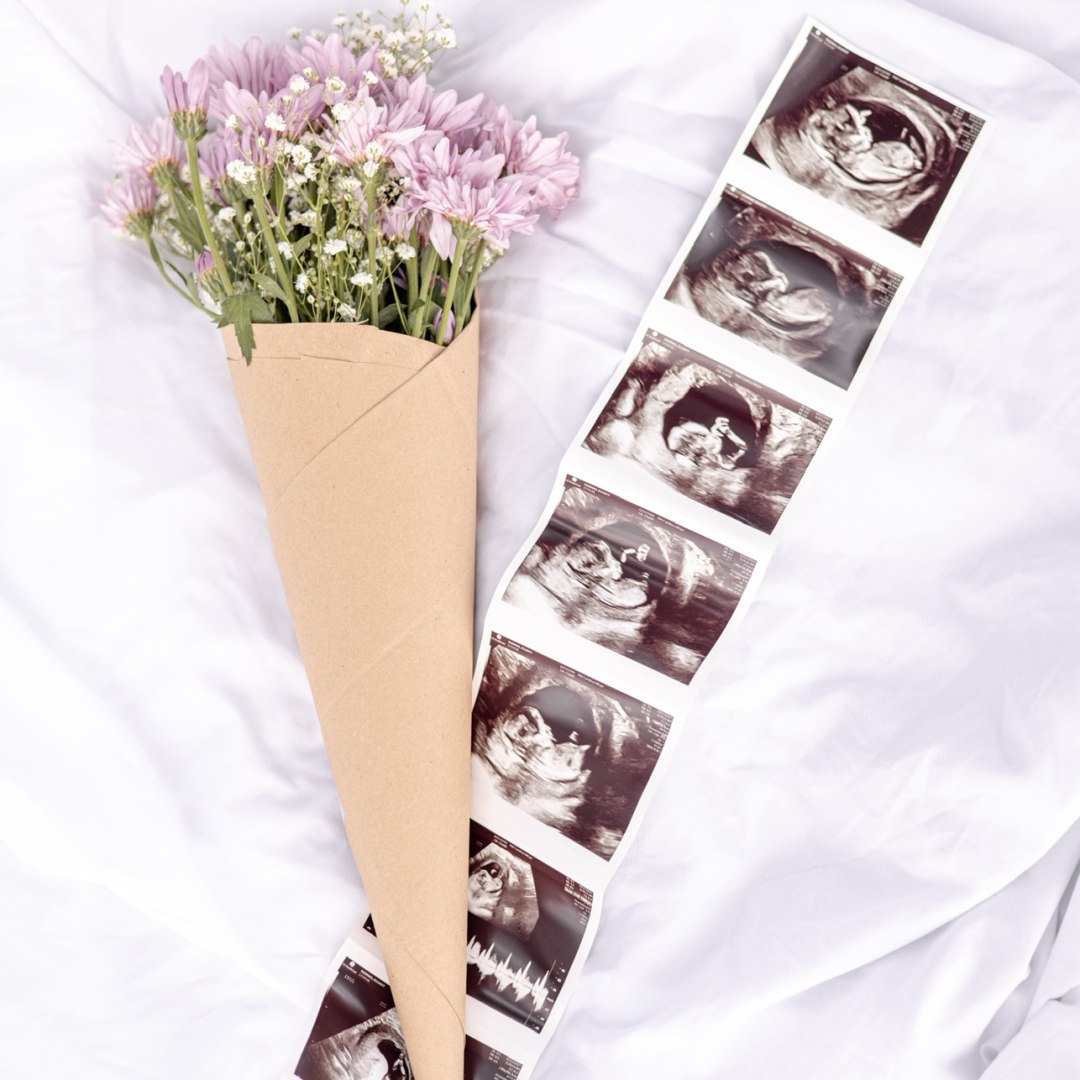 Photo shared by Elle for their Babylist baby registry.