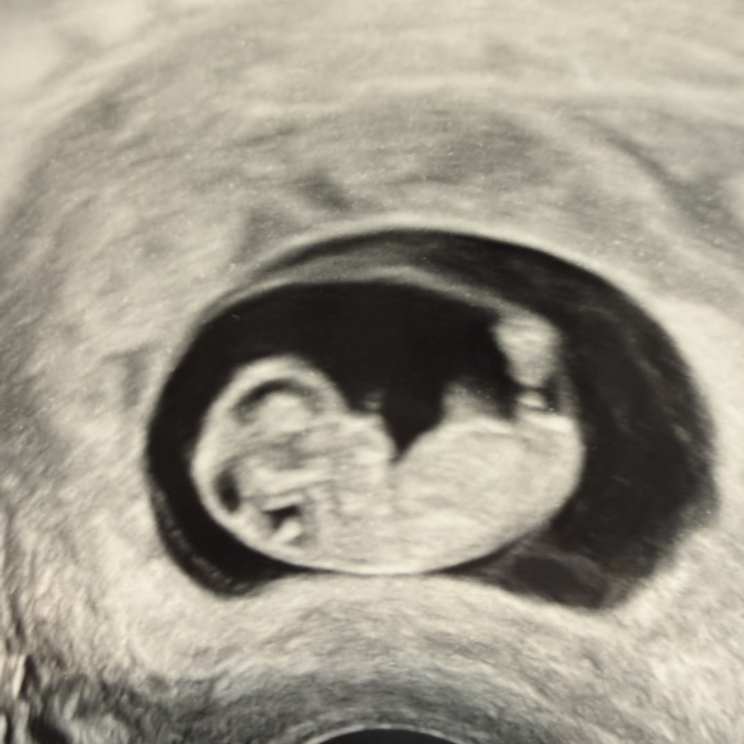 Photo shared by Rebecca for their Babylist baby registry.