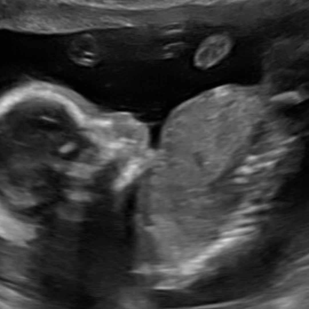 Photo shared by Nicolle for their Babylist baby registry.