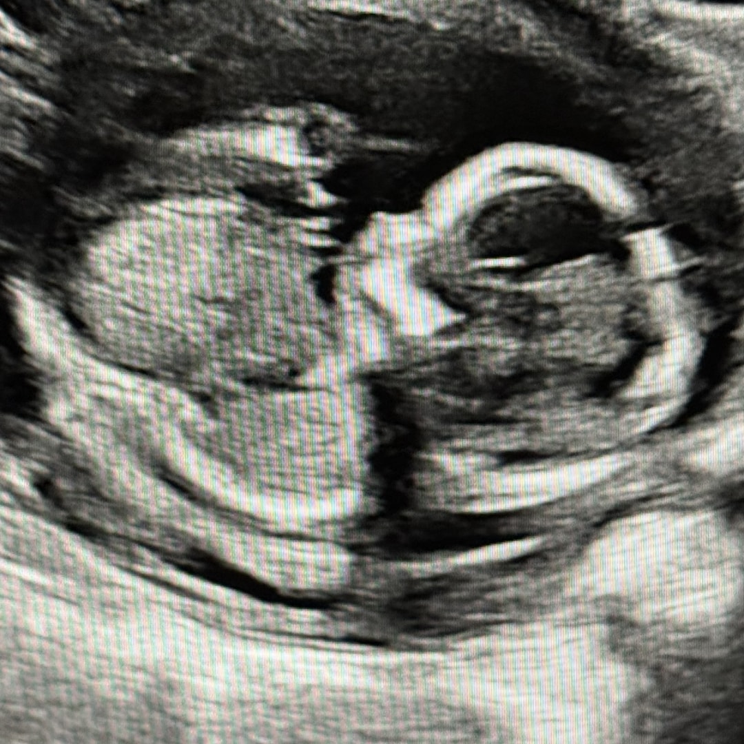 Photo shared by Heather for their Babylist baby registry.