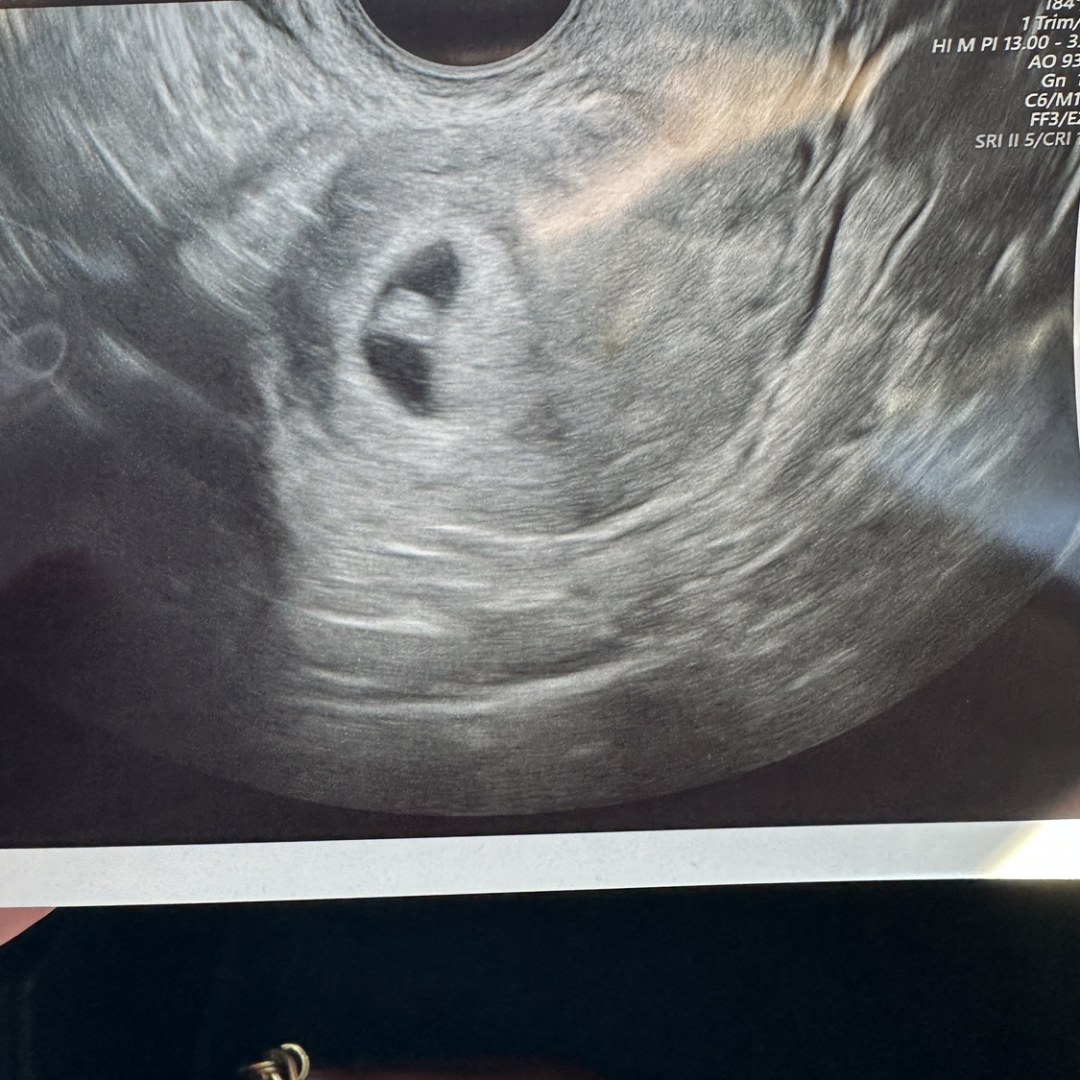 Photo shared by Emily for their Babylist baby registry.