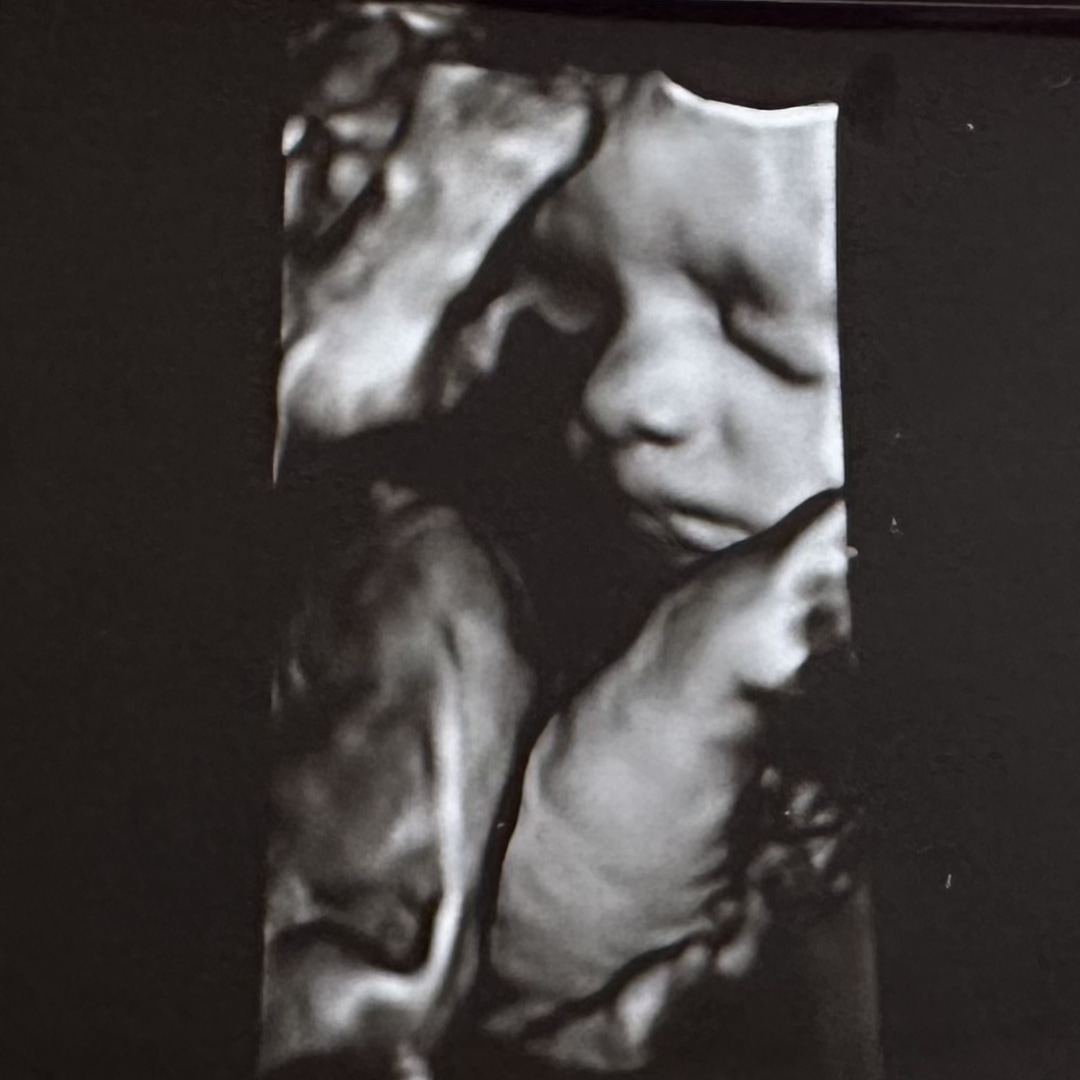 Photo shared by Hannah for their Babylist baby registry.
