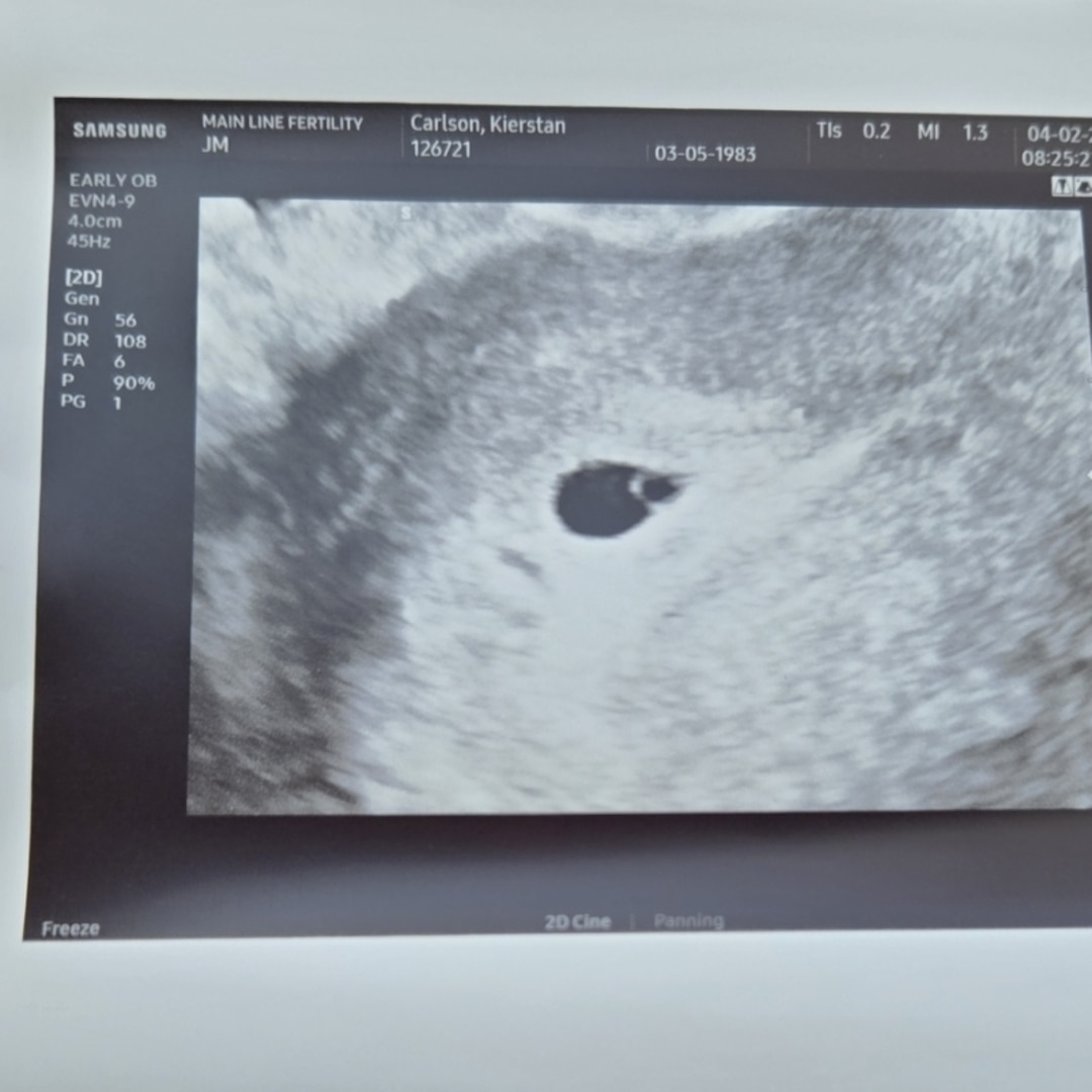 Photo shared by Kierstan for their Babylist baby registry.