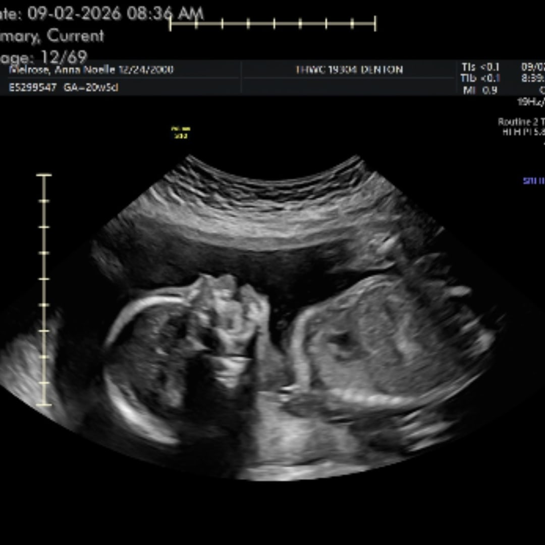 Photo shared by Anna for their Babylist baby registry.
