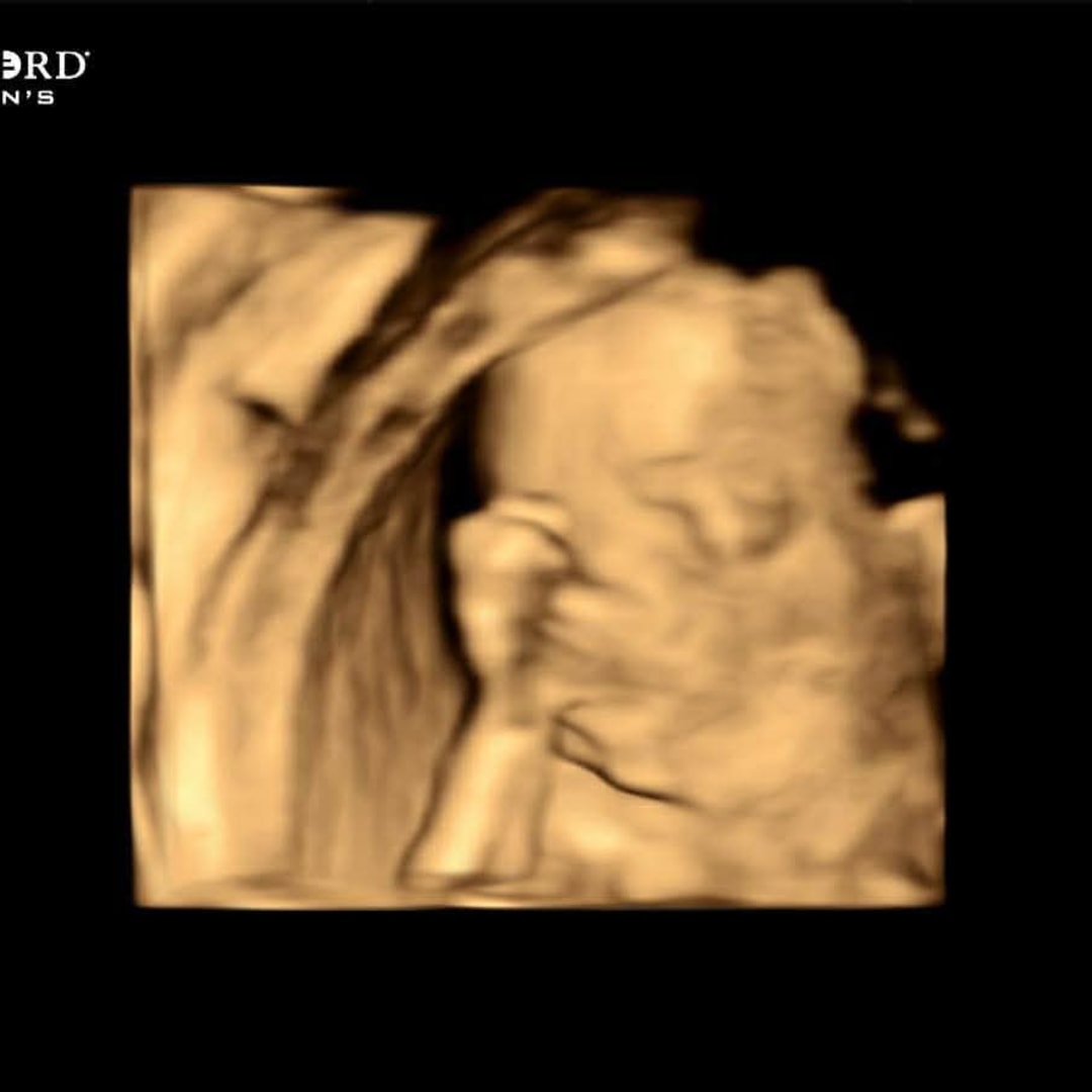 Photo shared by Zelda for their Babylist baby registry.