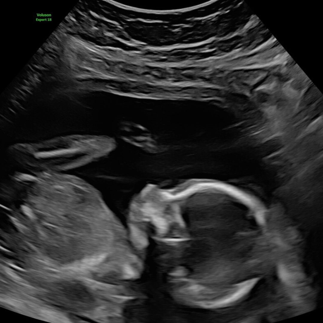 Photo shared by Dezaree for their Babylist baby registry.