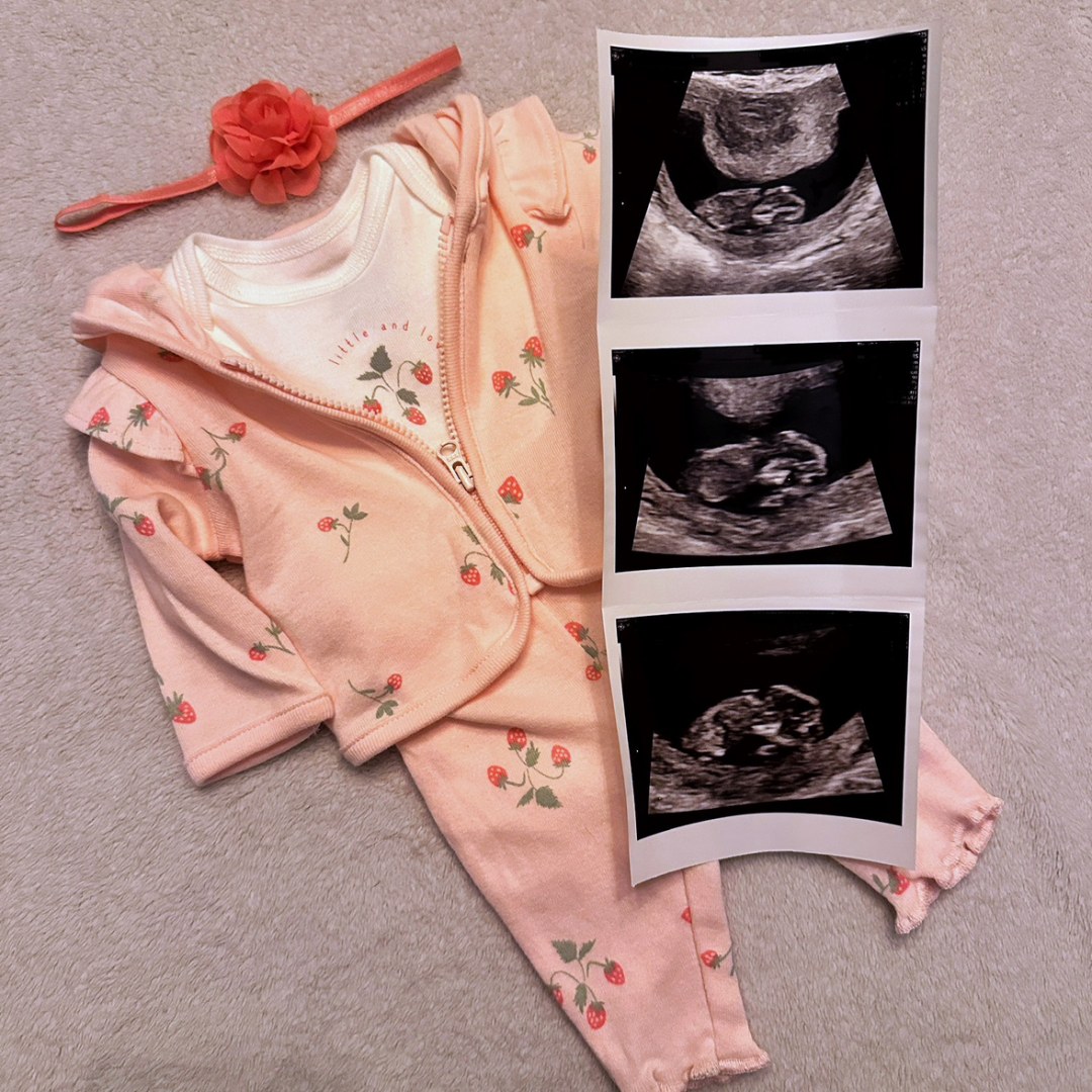 Photo shared by Hannah for their Babylist baby registry.