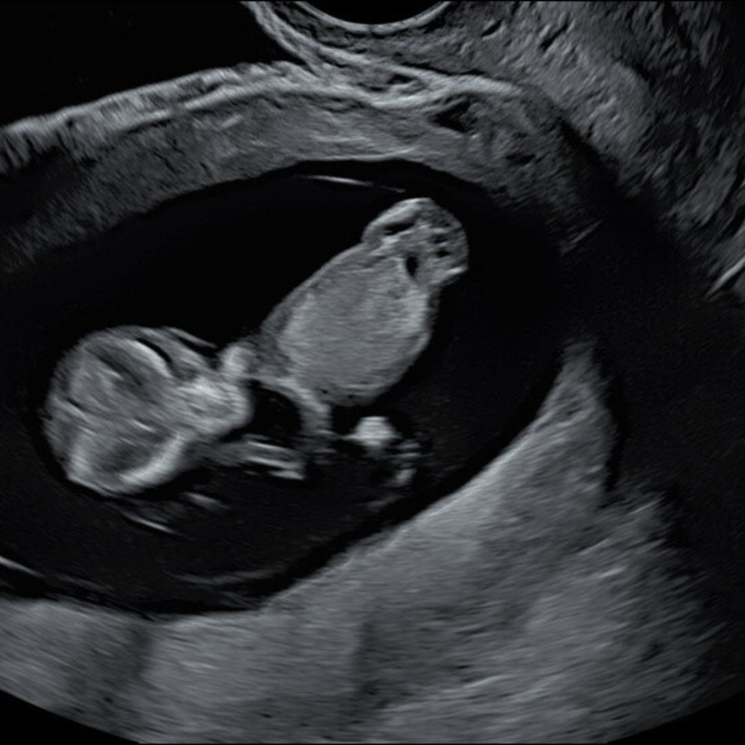 Photo shared by Cheyenne for their Babylist baby registry.