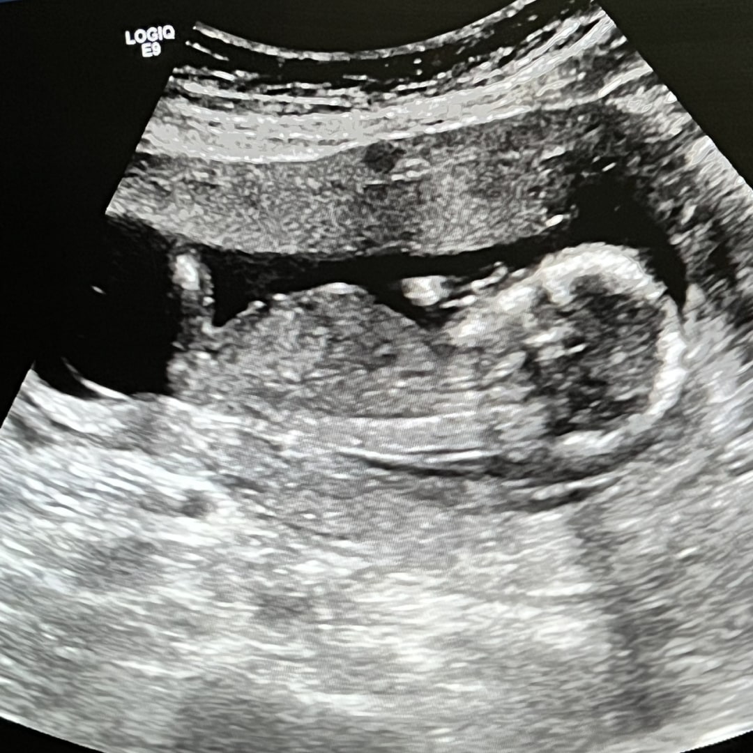 Photo shared by Mehwish for their Babylist baby registry.
