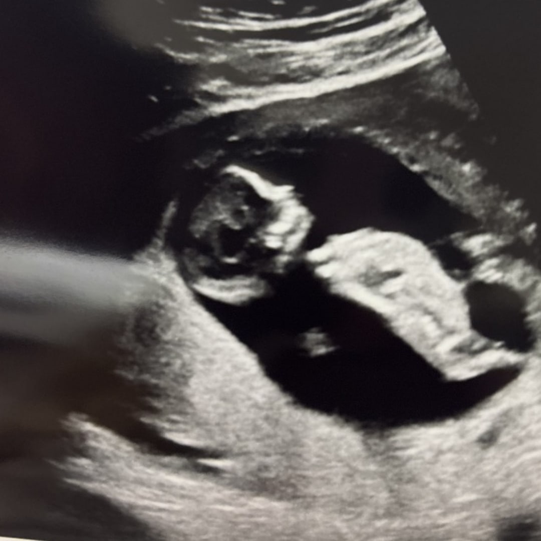 Photo shared by Ema for their Babylist baby registry.