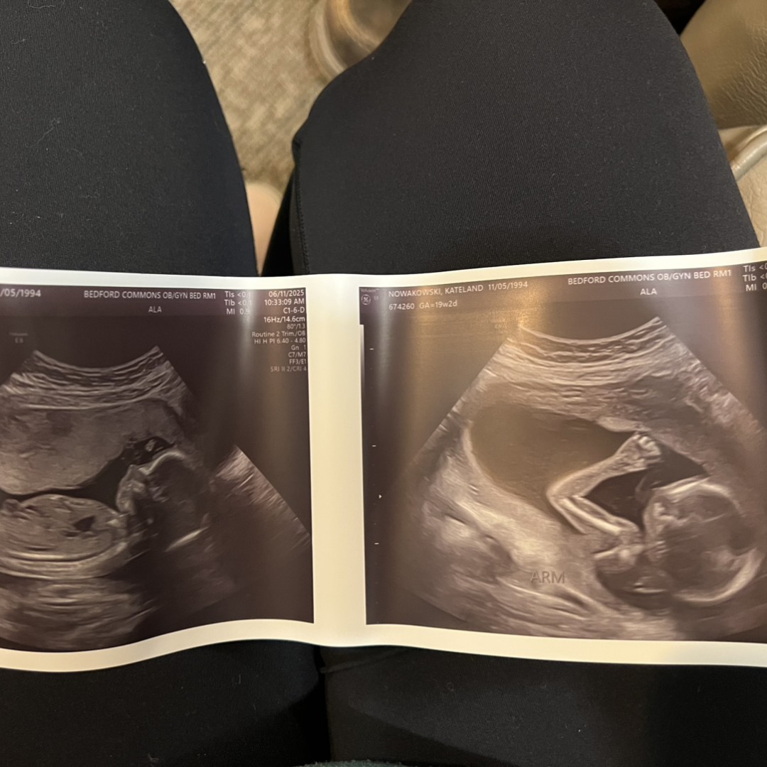 Photo shared by Kate for their Babylist baby registry.