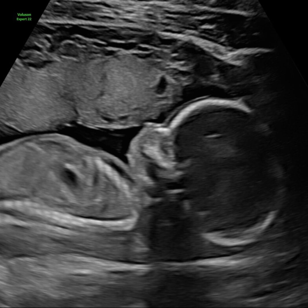 Photo shared by Wystria for their Babylist baby registry.