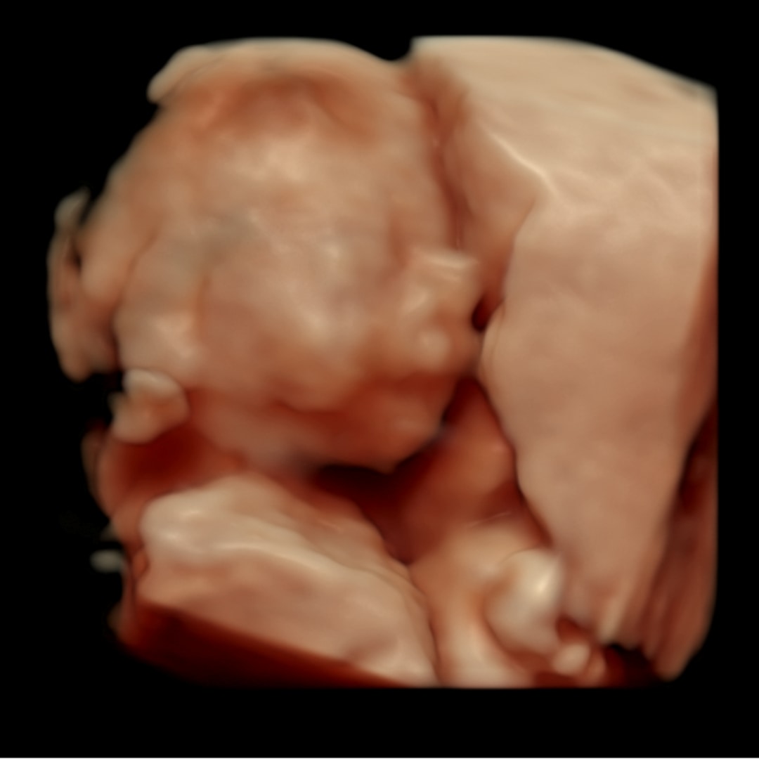 Photo shared by Christina for their Babylist baby registry.