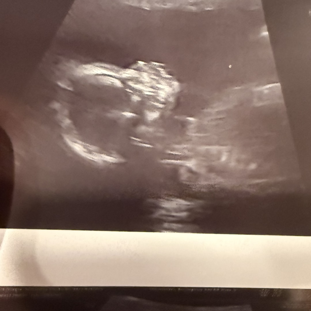 Photo shared by Julianna for their Babylist baby registry.