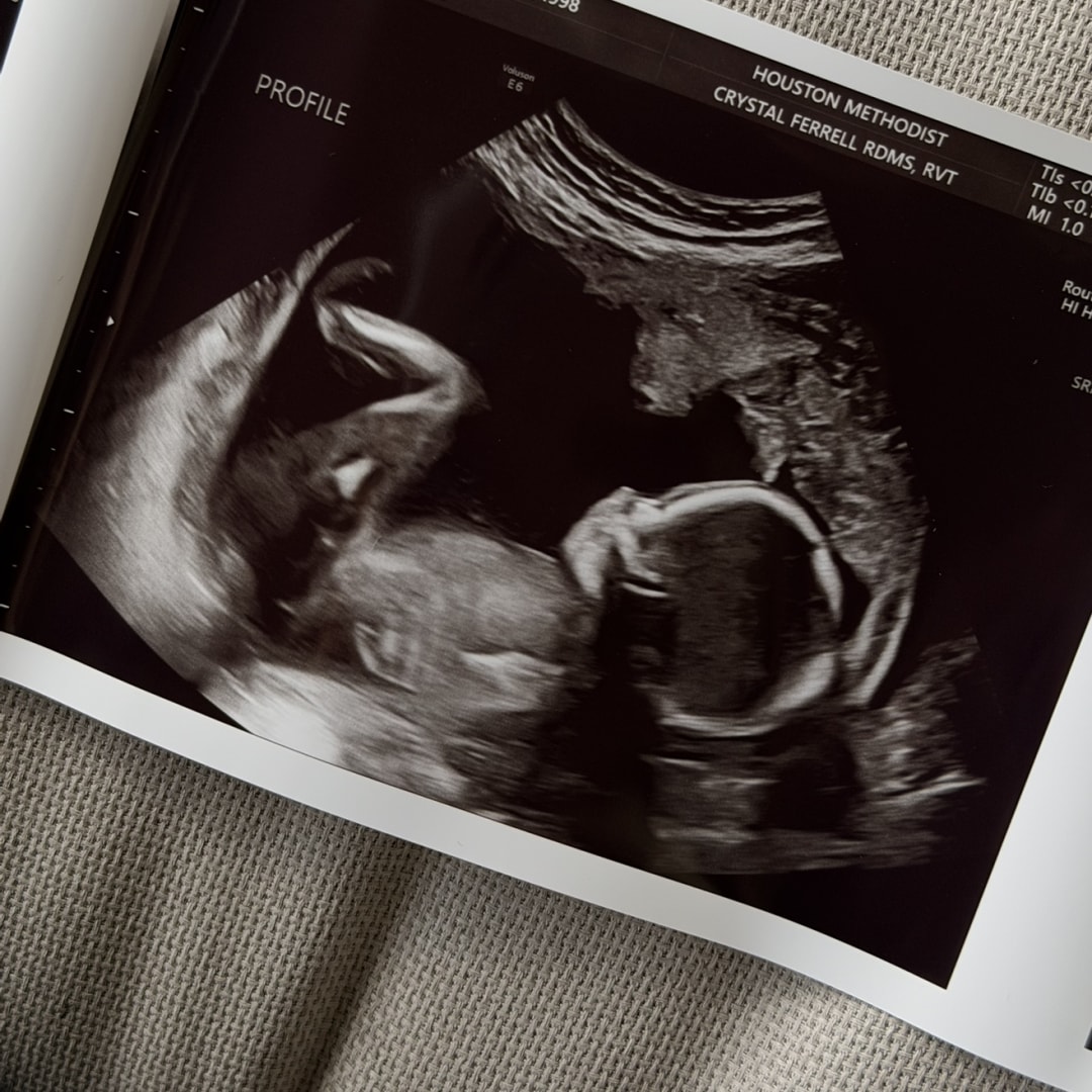 Photo shared by Daniela for their Babylist baby registry.