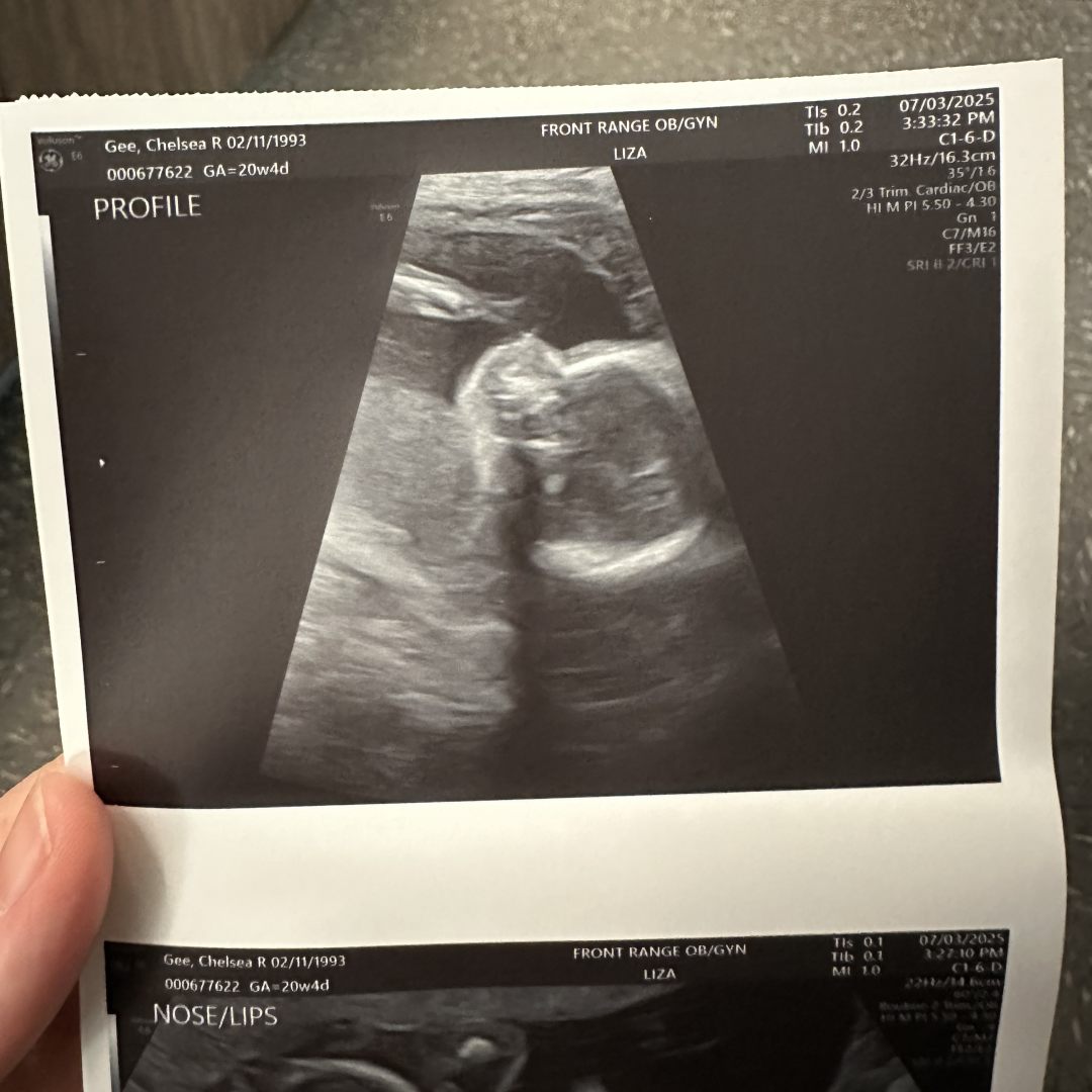 Photo shared by Chelsea for their Babylist baby registry.