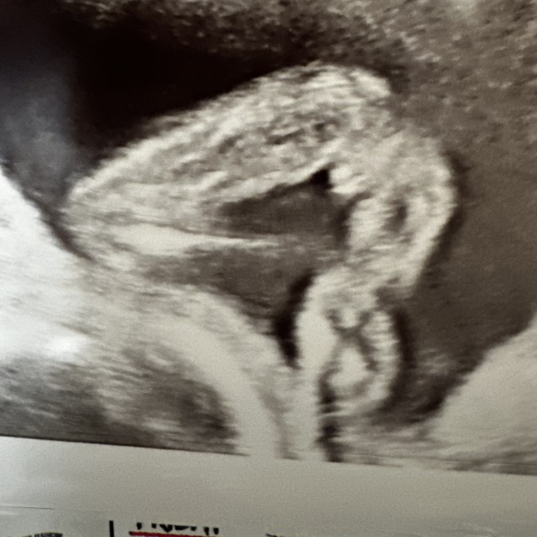 Photo shared by Jennifer for their Babylist baby registry.