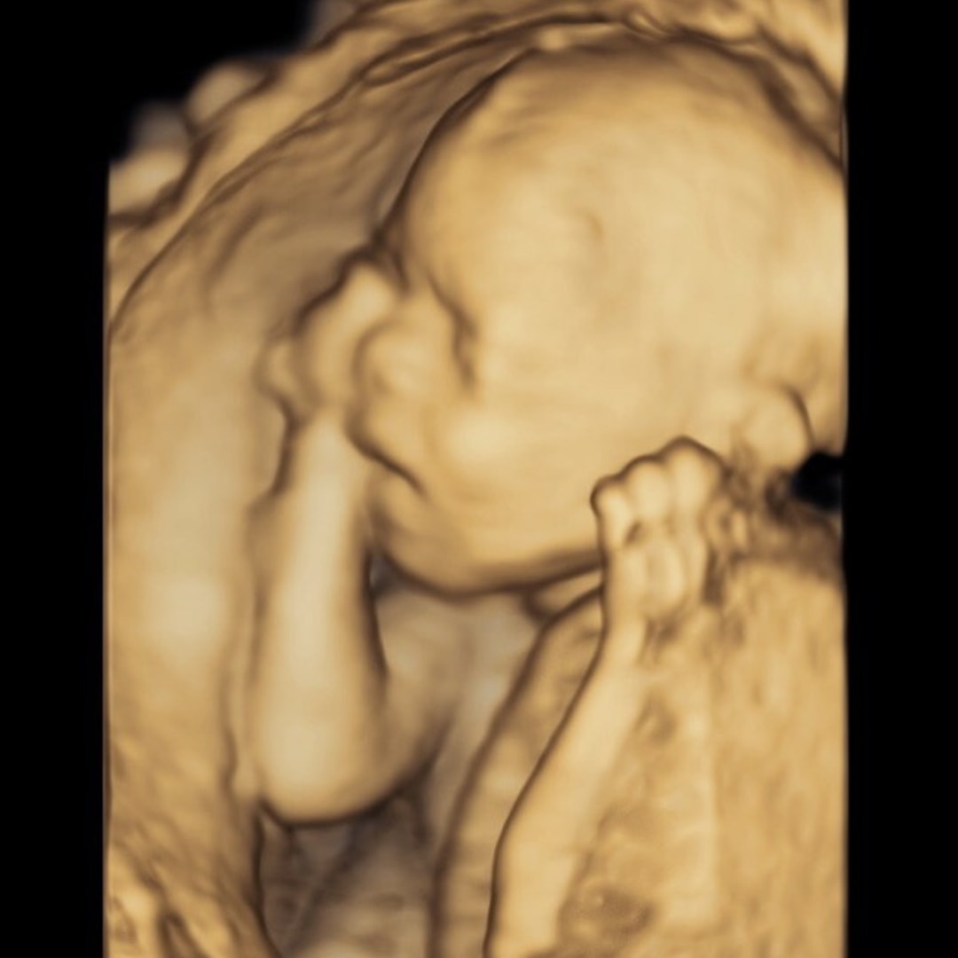 Photo shared by Chrissy for their Babylist baby registry.