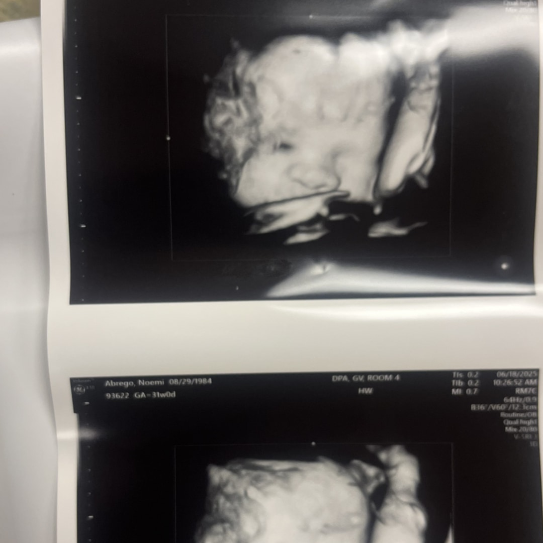 Photo shared by Noemi for their Babylist baby registry.