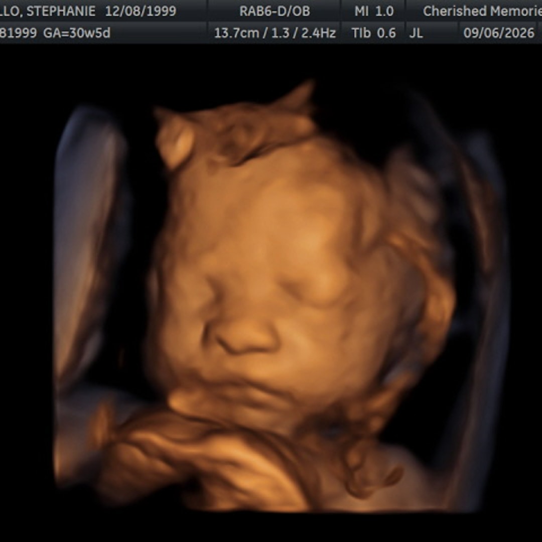 Photo shared by Stephanie for their Babylist baby registry.