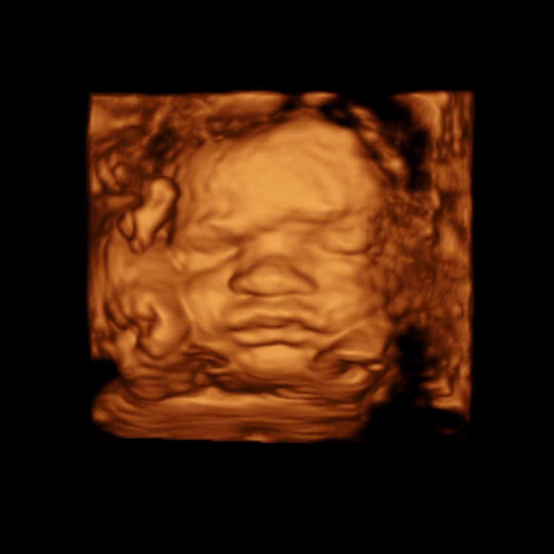 Photo shared by Dawson for their Babylist baby registry.