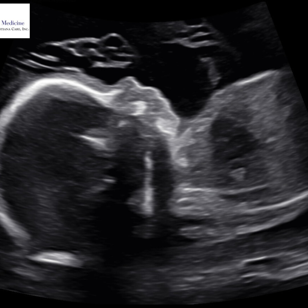 Photo shared by Kelsey for their Babylist baby registry.
