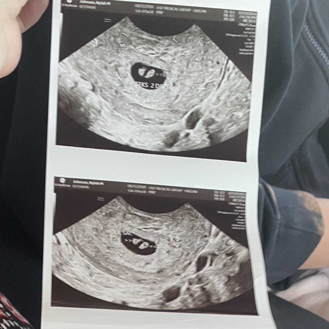Photo shared by Nylah for their Babylist baby registry.