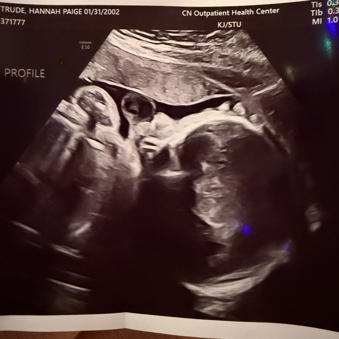 Photo shared by Hannah for their Babylist baby registry.