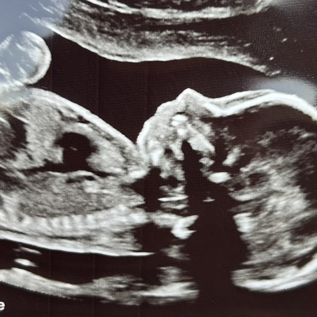 Photo shared by Alaina for their Babylist baby registry.