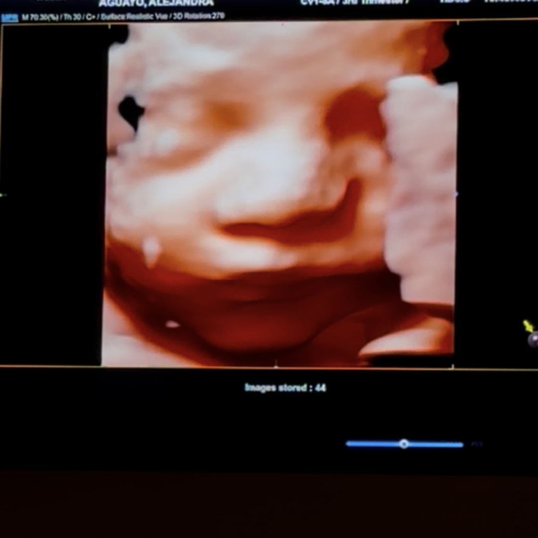 Photo shared by Alejandra for their Babylist baby registry.
