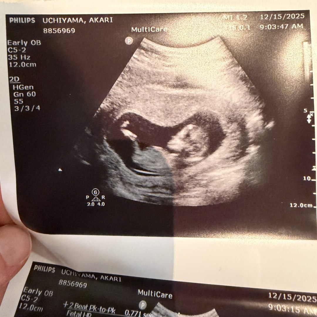 Photo shared by Brandon for their Babylist baby registry.