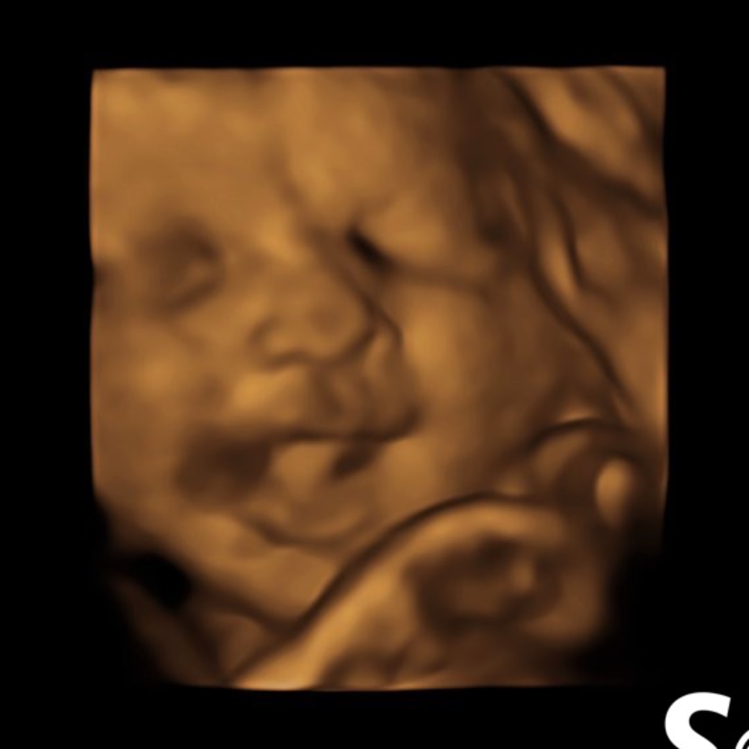 Photo shared by Chazlyn for their Babylist baby registry.