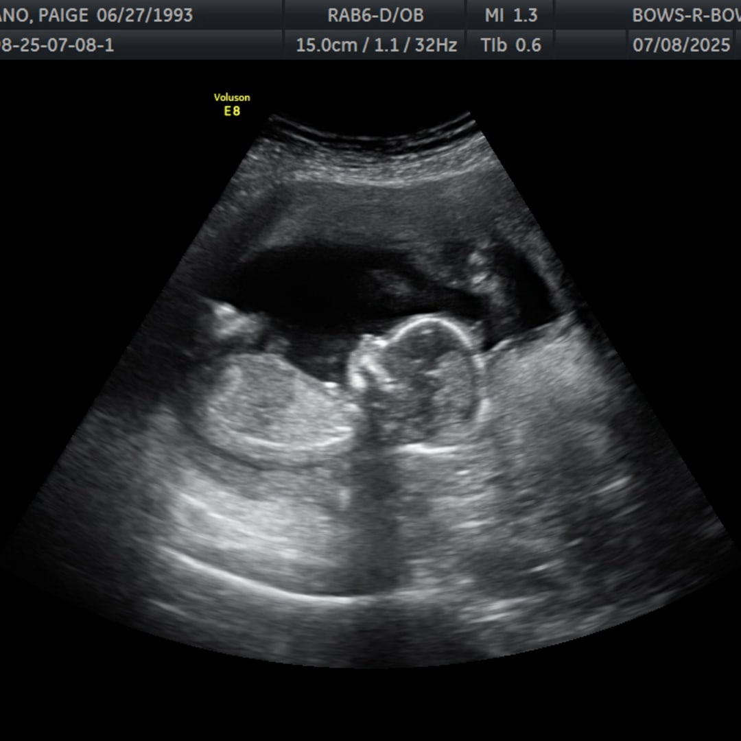 Photo shared by Paige for their Babylist baby registry.
