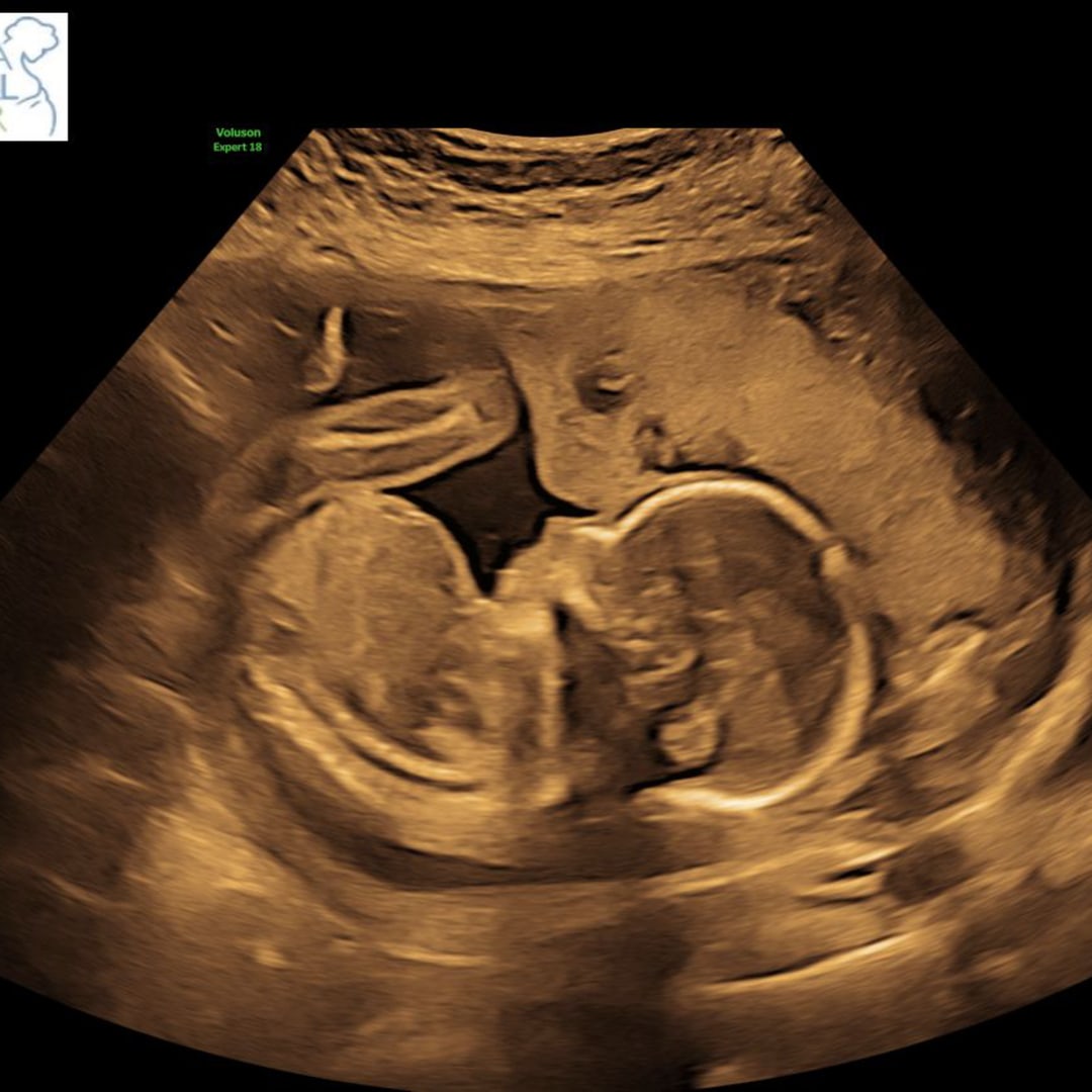Photo shared by Savannah for their Babylist baby registry.
