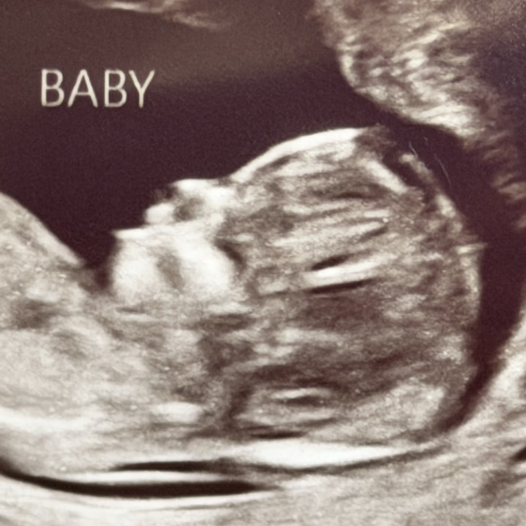 Photo shared by Isabelle for their Babylist baby registry.