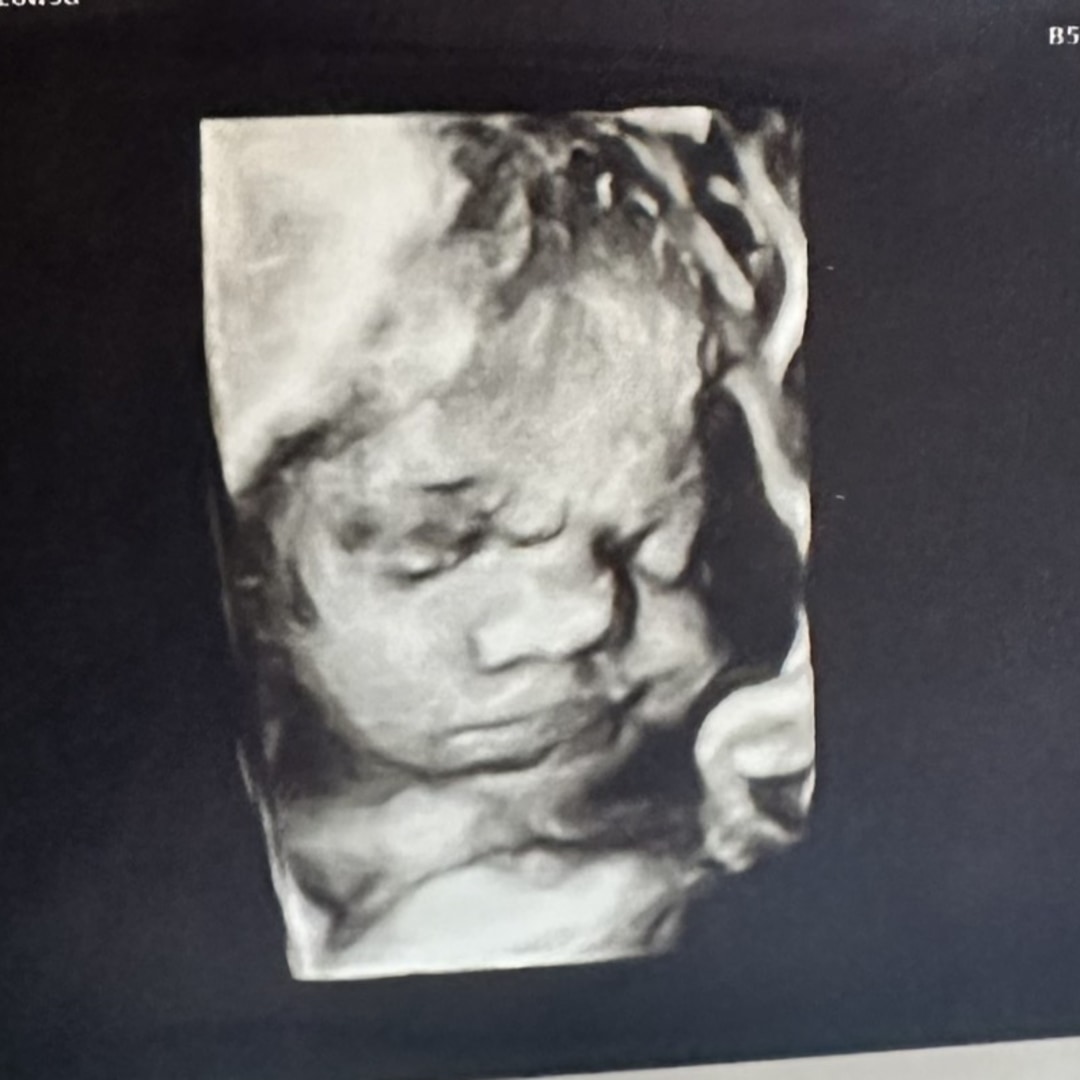 Photo shared by Amethyst for their Babylist baby registry.
