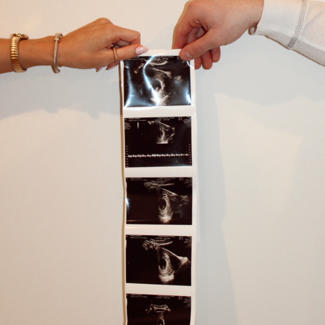 Photo shared by Caroline for their Babylist baby registry.