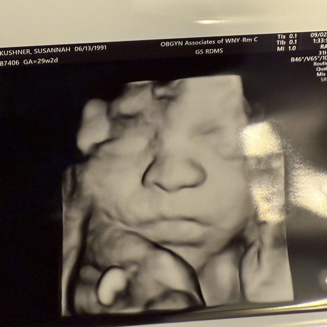 Photo shared by Susie for their Babylist baby registry.