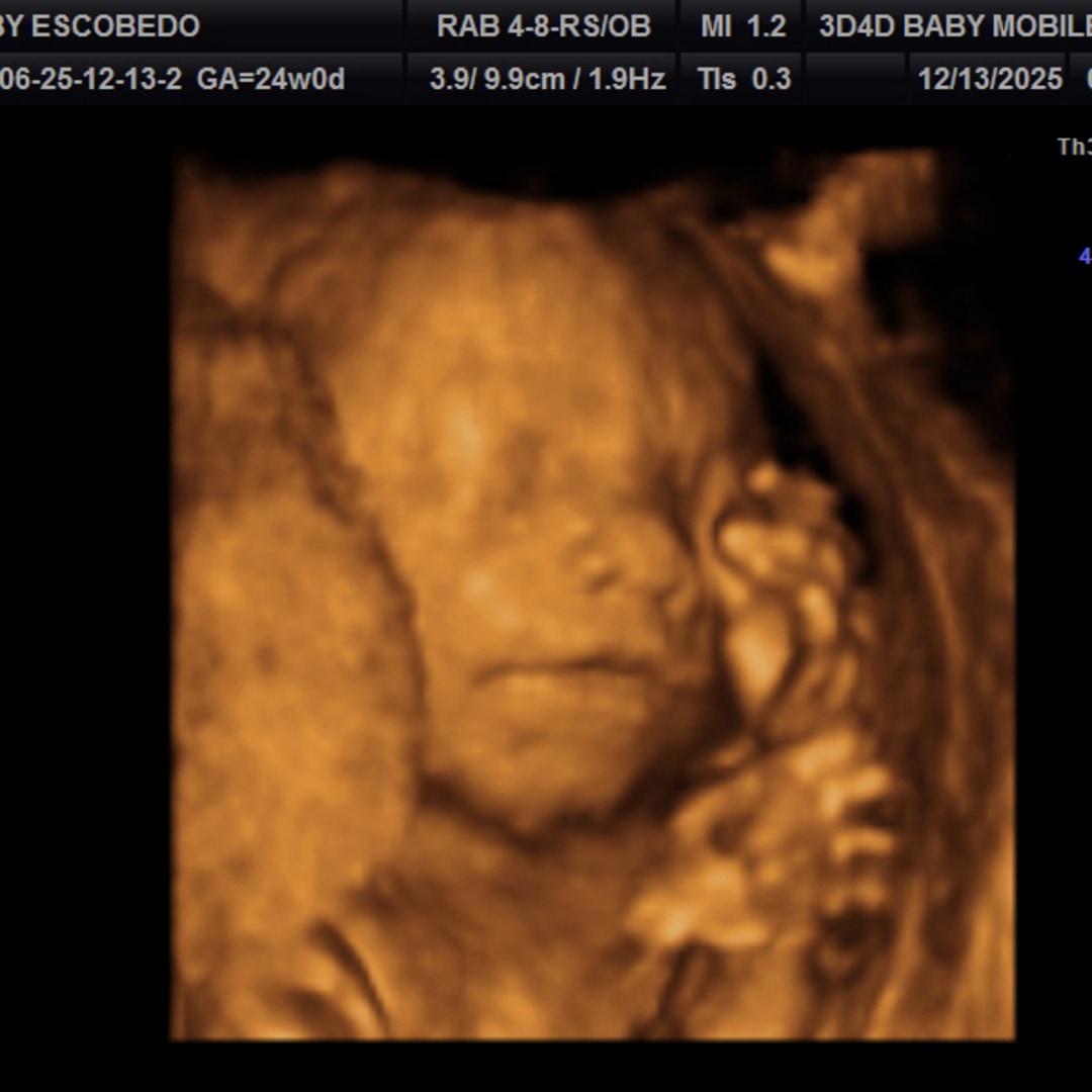 Photo shared by Meritza for their Babylist baby registry.