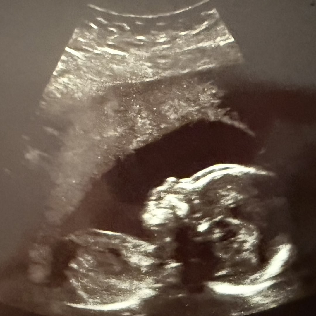 Photo shared by Destinee for their Babylist baby registry.