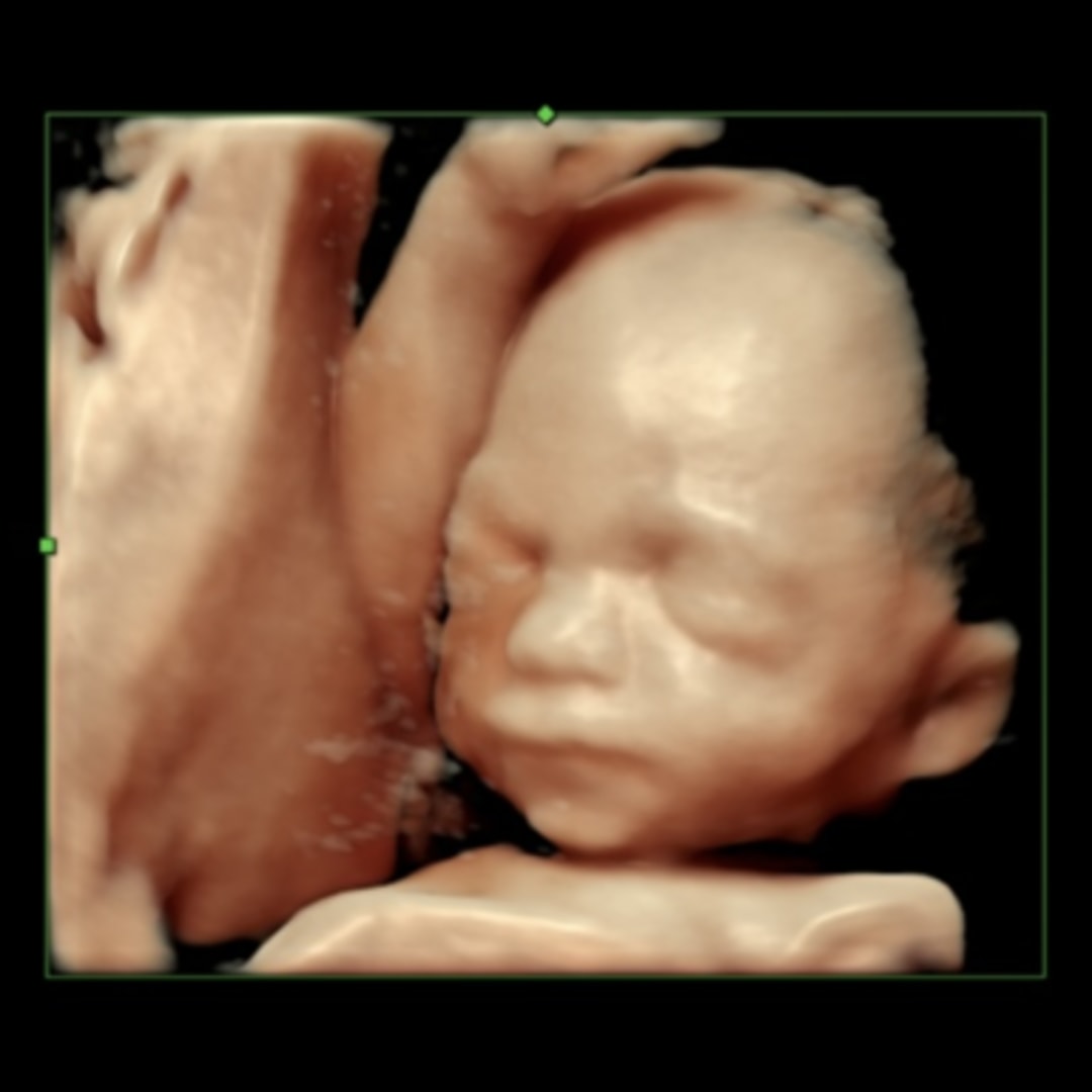 Photo shared by Leelee for their Babylist baby registry.
