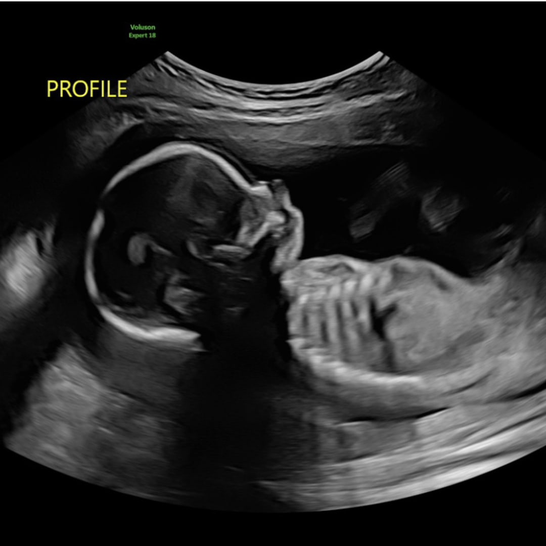 Photo shared by Cindell for their Babylist baby registry.