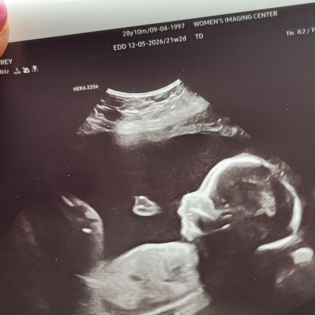 Photo shared by Aubrey for their Babylist baby registry.