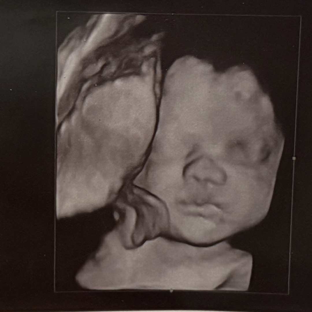 Photo shared by Kaitlyn for their Babylist baby registry.