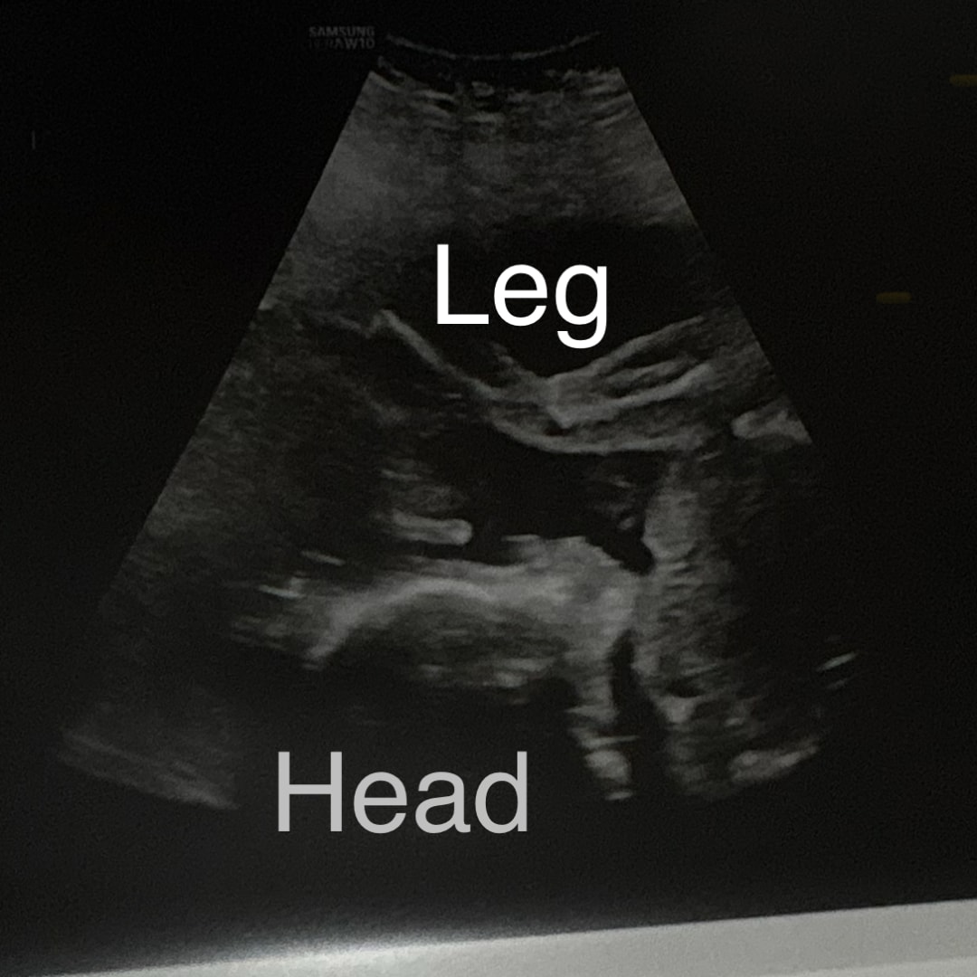 Photo shared by Victoria for their Babylist baby registry.