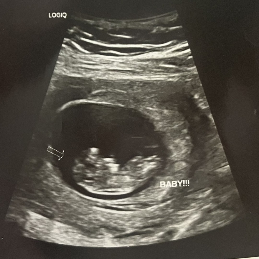 Photo shared by Kimberley for their Babylist baby registry.