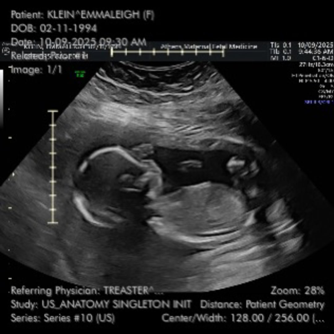 Photo shared by Emmaleigh for their Babylist baby registry.