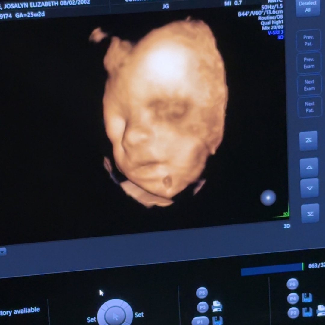 Photo shared by Josalyn for their Babylist baby registry.
