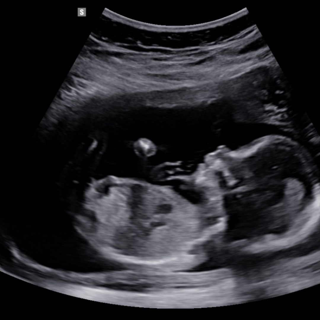Photo shared by Daisy for their Babylist baby registry.
