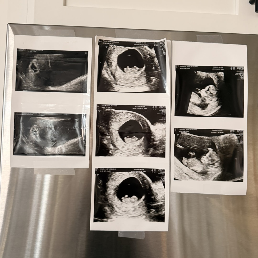 Photo shared by Haley for their Babylist baby registry.